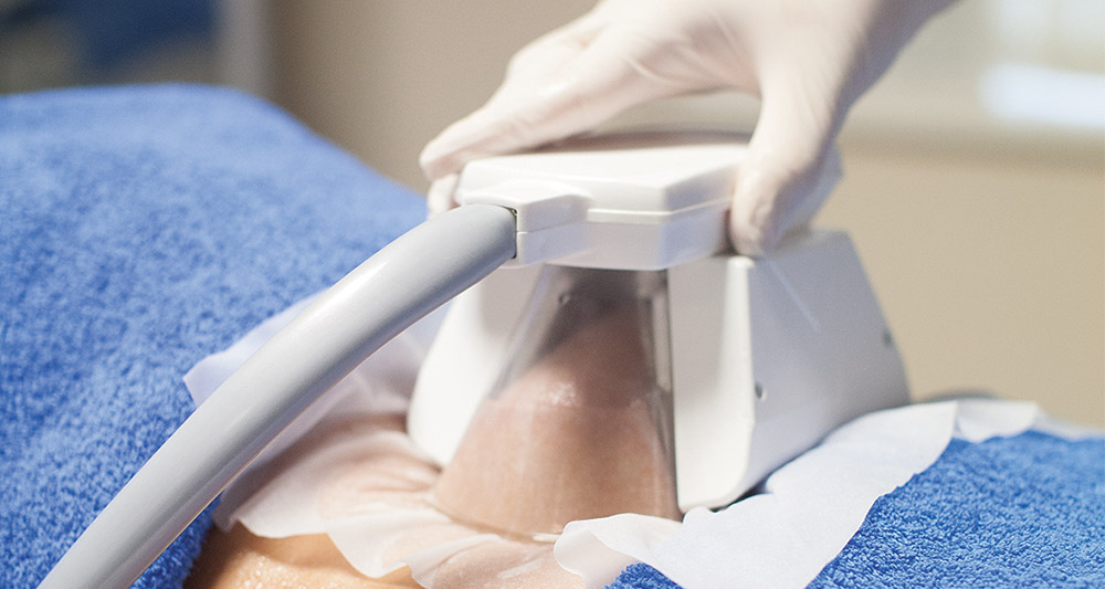 How Fat Freezing and HIFU Work Together? 2 Multiple Areas in One Session HIFU and Fat Freezing Shepperton Green