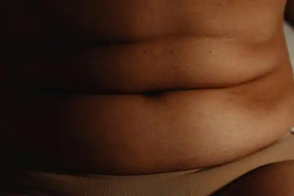 The Hidden Connection: How Stress Shapes Your Fitness and Body Composition 3 image of what stress can do on the stomach area and how Lipo 360 Shepperton Green can help to change your body shape.