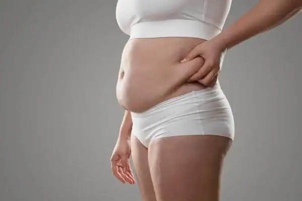 The Hidden Connection: How Stress Shapes Your Fitness and Body Composition 1 Image of stress belly Shepperton Green How Lipo 360 can help manage your symptoms